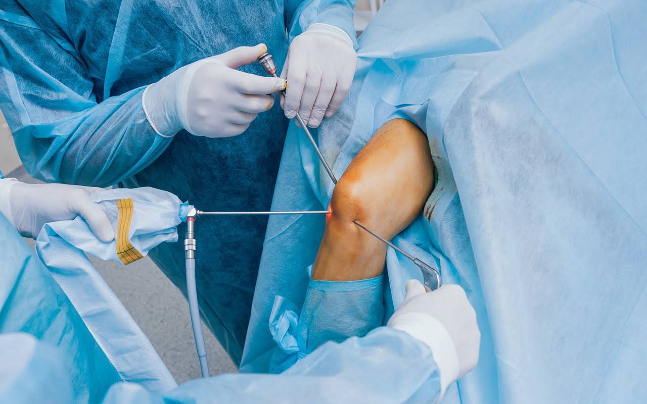 Knee arthroscopy product image