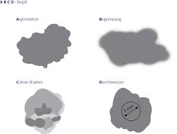 Hautkrebs Basaliom Melanom Hautscreening Info Medizin