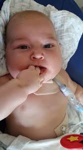 His recovery is going to be at a snail's pace. 😊🐌