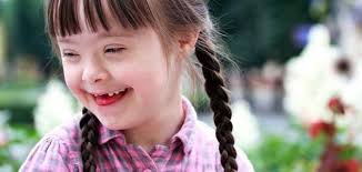 نتيجة بحث الصور عن داون