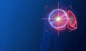 Image result for Targeted Cancer Therapy