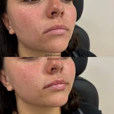 Leah Wheaton MSN,FNP-C (@leahwheaton_np) • Instagram photos and videos