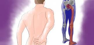 Pin On Sante Medecine