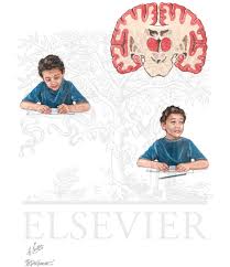 Image result for Absence Seizure