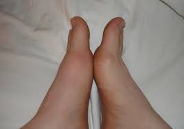 Pin On Home Remedies