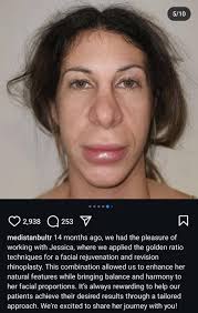 You're not ugly you're just poor 🤷‍♂️