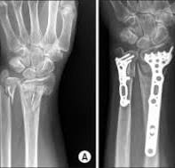 JKOA :: The Journal of the Korean Orthopaedic Association