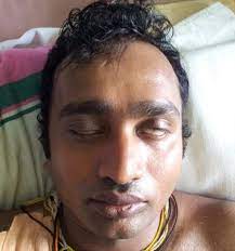 Maybe you would like to learn more about one of these? Guillain Barre Syndrome Following Dengue Fever And Literature Review Bmc Research Notes Full Text