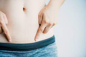 The Untapped Strategy You Need To Stop Your C Section Scar From Itching Today She Births Bravely