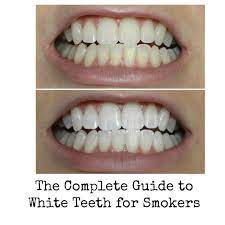 Pin On Teeth Whitening Before After Results