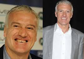 Under deschamps, france have so. Didier Deschamps Dit Pourquoi Il S Est Fait Refaire Les Dents Elle