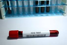 I missed my period already. What Is A Positive Beta Hcg Level 2 Types Of Hcg Tests