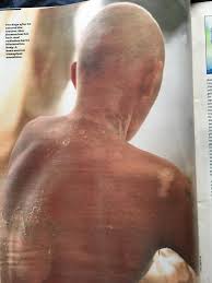 See the article in its original context from may 31, 1986, section 1, page 4 buy. Life Magazine From August 1986 Showing The Victims Of Chernobyl Album On Imgur