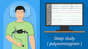 Image result for Sleep Apnea