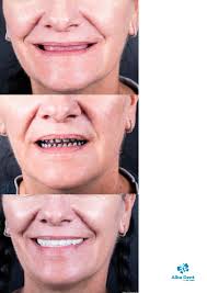 Alba Dent by Dr. Bara