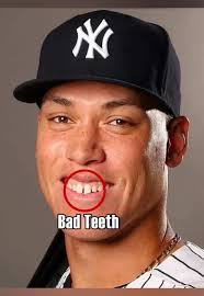 How Does Aaron Judge Look As A Beard