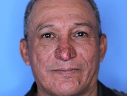 Pintaba una casa, le contó al dueño el calvario que sufría por su nariz y  cambió su vida