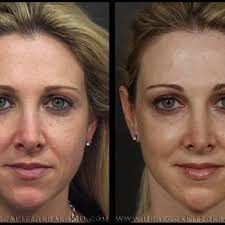 REBECCA FITZGERALD, MD