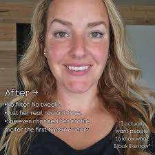 Kat Parks, Face Yoga Method Instructor (@beeasyfaceyoga) • Instagram photos  and videos