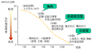 貨 スマート家電・スマートホームデバイス 家電・電化製品 diyグッズ ペッ. ã‚‚ã®å¿˜ã‚Œ èªçŸ¥ç—‡ ã‚¢ãƒ«ãƒ„ãƒã‚¤ãƒžãƒ¼ç—…ã®è¨ºæ–­ æ²»ç™‚ ããã‹ã‚ã‚¯ãƒªãƒ‹ãƒƒã‚¯