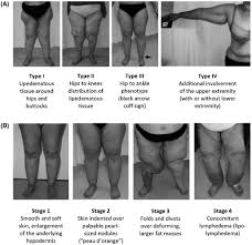 Pin On Health And Well Being