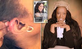 Ppd can be found in commercial hair dyes under many alternative names. Woman S Allergic Reaction To L Oreal Hair Dye Left Her Hours From Death Daily Mail Online