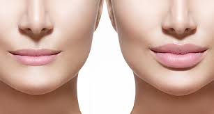 Try to take a quick look on wowhead or wowpedia next time you have a question like this. How Long Does Juvederm Last A Top Cosmetic Surgeon Explains