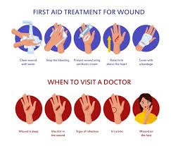 The wound and the stitches that hold it together may be cleansed gently with mild soap and water after 24 hours. Free Vector Surgical Suture Stitches Realistic Composition With Isolated Images Of Human Hand At Different Stages Of Stitching