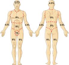 Rule Of Nines Calculate By Qxmd