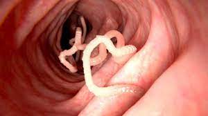 Häufig wird der bandwurm in menschen bemerkt, wenn man im stuhl winzige, weiße, reiskornähnliche wurmeier oder die larven entdeckt. Bandwurm Beim Menschen Symptome Therapie Herold At