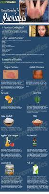 130 Psoriasis And Psoriatic Arthritis Ideas Psoriatic Psoriatic Arthritis Arthritis
