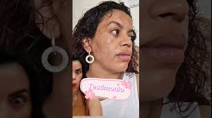 DUO QUITA MANCHAS CALENDULA