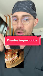 ¿Que hacemos cuando un diente no ha salido? #drwillortodoncista  #ortodonciacdmx #saludbucal