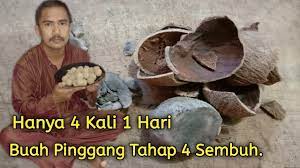 Check spelling or type a new query. Ubat Sakit Buah Pinggang Tahap 4 Paling Ampuh Mujarab Youtube