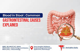 Image result for Blood in stool