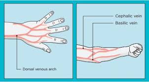 Iv Presentation