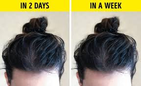 Embrace the messy look by twisting the hair, rolling it to one side and pinning it into place. 7 Reasons Why Hair Gets Greasy So Fast And What Can You Do About It