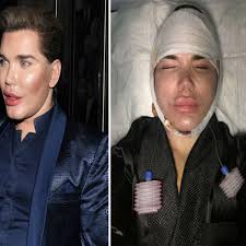 We did not find results for: What Is Human Ken Doll Rodrigo Alves Net Worth And What Did He Look Like Pre Surgery Daily Star