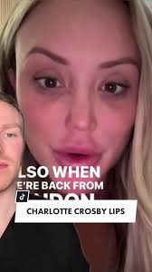 Charlotte Crosby's Lip Filler Dissolving: A Cautionary Tale
