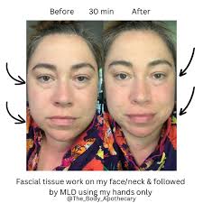 I've been doing a lot of MLD