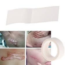 More images for how to use silicone tape for scars » Scar Away Treatment Sheet Tape Repair Silicone Gel Strips Patch Medical Reusable Feet Aliexpress