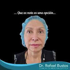 Dr. Rafael Bustos. Clínicas de Medicina Estética (@doctorrafaelbustos) •  Instagram photos and videos