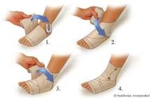 Image result for how do you wrap a figure 8 bandage