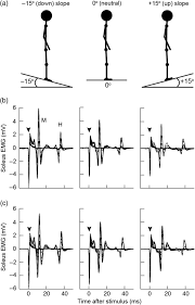 Middle finger and thumb response. Effect Of Ankle Angles On The Soleus H Reflex Excitability During Standing In Motor Control Volume 24 Issue 2 2020