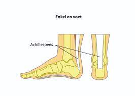 Ik Heb Last Van Mijn Achillespees Thuisarts