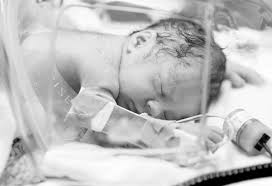 Синдром рейе (cр) (по мкб 10: Edwards Syndrome In Infants Reasons Symptoms Treatment
