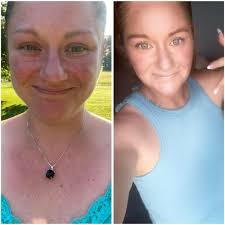 Looking healthy. Congratulations!