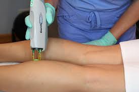 This new, fda approved laser promises the largest spot area of any technology. Laser Hair Removal Chicago Il Lapiel Laser Center