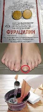 как сделать мазь от грибка ногтей из яйца и уксуса Hobbi Zdorove Domashnie Sredstva Domashnee Lechenie