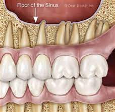 Sensitive Teeth Pain David L Pastrell Dds